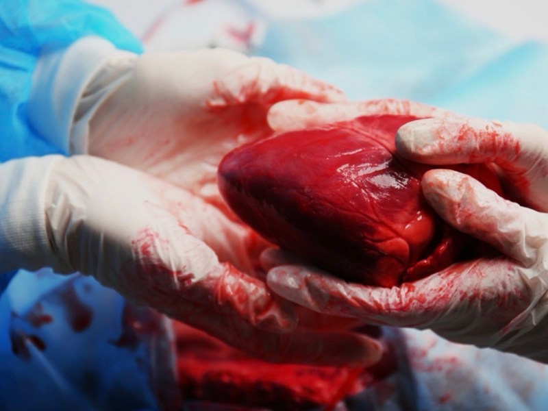 Have a Heart!